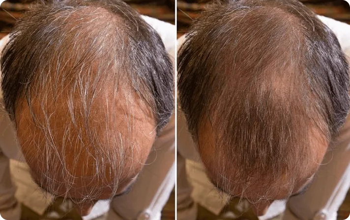 Before and after — hair care result 1