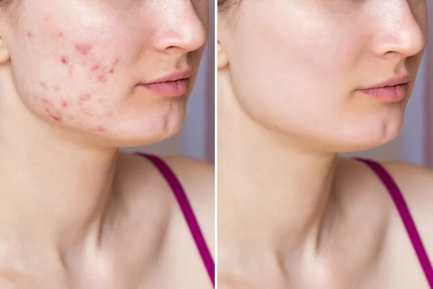 Before and after — skin care result 1